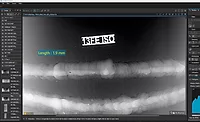 Durr ndt weld inspection radiography Durr ndt weld inspection radiography