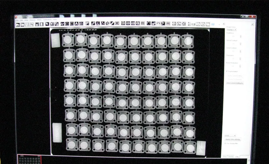radiograph