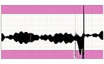A chart recording showing a region below the minimum required wall thickness.