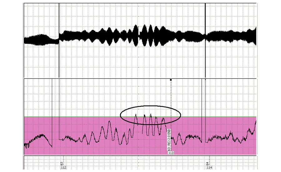A chart recording showing a region with too wide a variation in wall thickness.