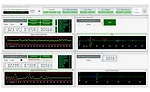 Figure 15: Multi-channel user interface showing four active channels.