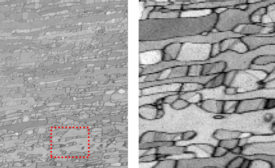 Figure 1 - EBSD pattern quality maps for a duplex steel at low (left) and high (right) magnifications. 