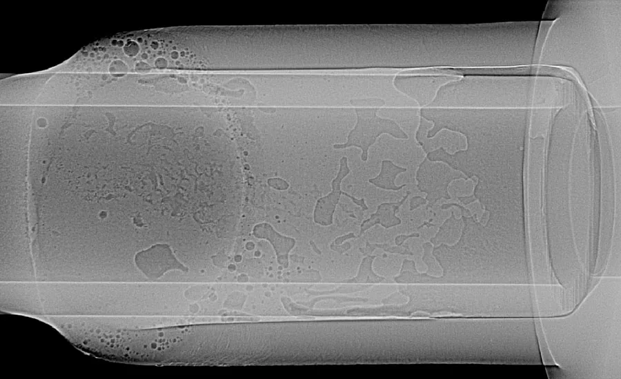 Figure 1. Superimposed DR images