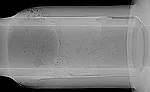 Figure 1. Superimposed DR images
