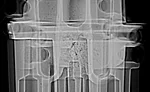 Figure 8. Superimposed DR images