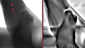 This comparison shows a casting with cavities, which the AI-supported module reliably detects – on the left in the image.