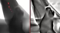This comparison shows a casting with cavities, which the AI-supported module reliably detects – on the left in the image.