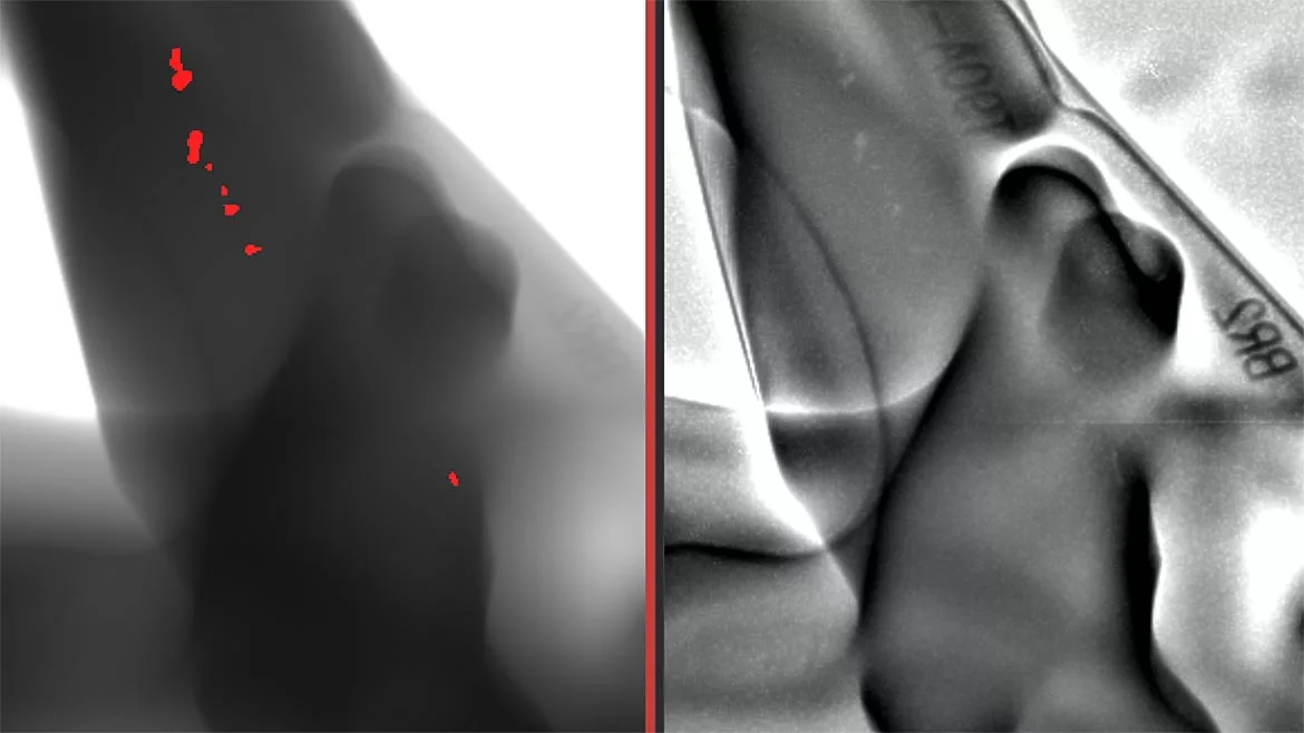 This comparison shows a casting with cavities, which the AI-supported module reliably detects – on the left in the image.