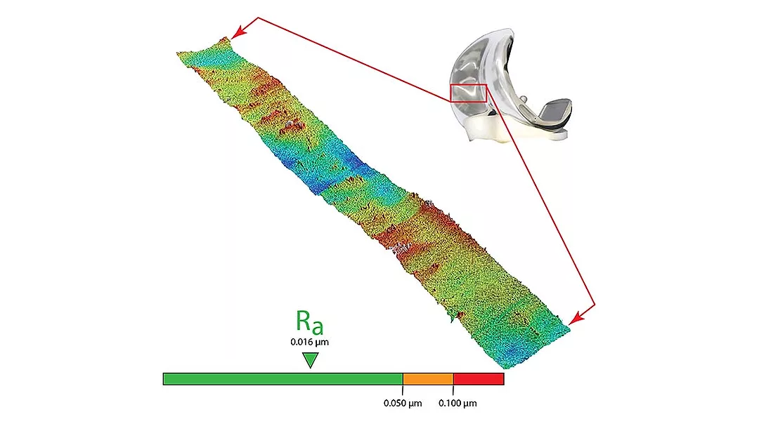 The image illustrates a surface texture analysis, specifically measuring the roughness parameter "Ra" on a metallic orthopedic implant.